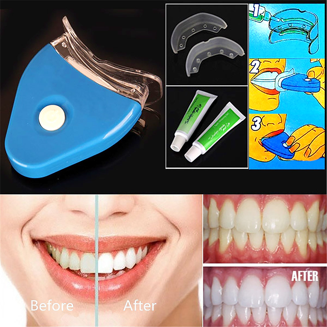 Oral Gel Teeth Tooth Whitening Bleaching LED - Dental Tools -  Trend Goods