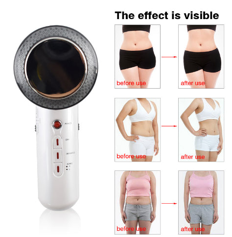 Beauty Care Slimming Device Handheld Ultrasound Body Fat Remove Massager - Electric Massagers -  Trend Goods